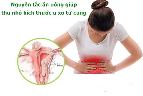 3 nguyên tắc ăn uống giúp thu nhỏ kích thước u xơ tử cung